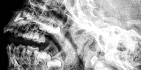 Red & Infrared LED Therapy for TMD Pain